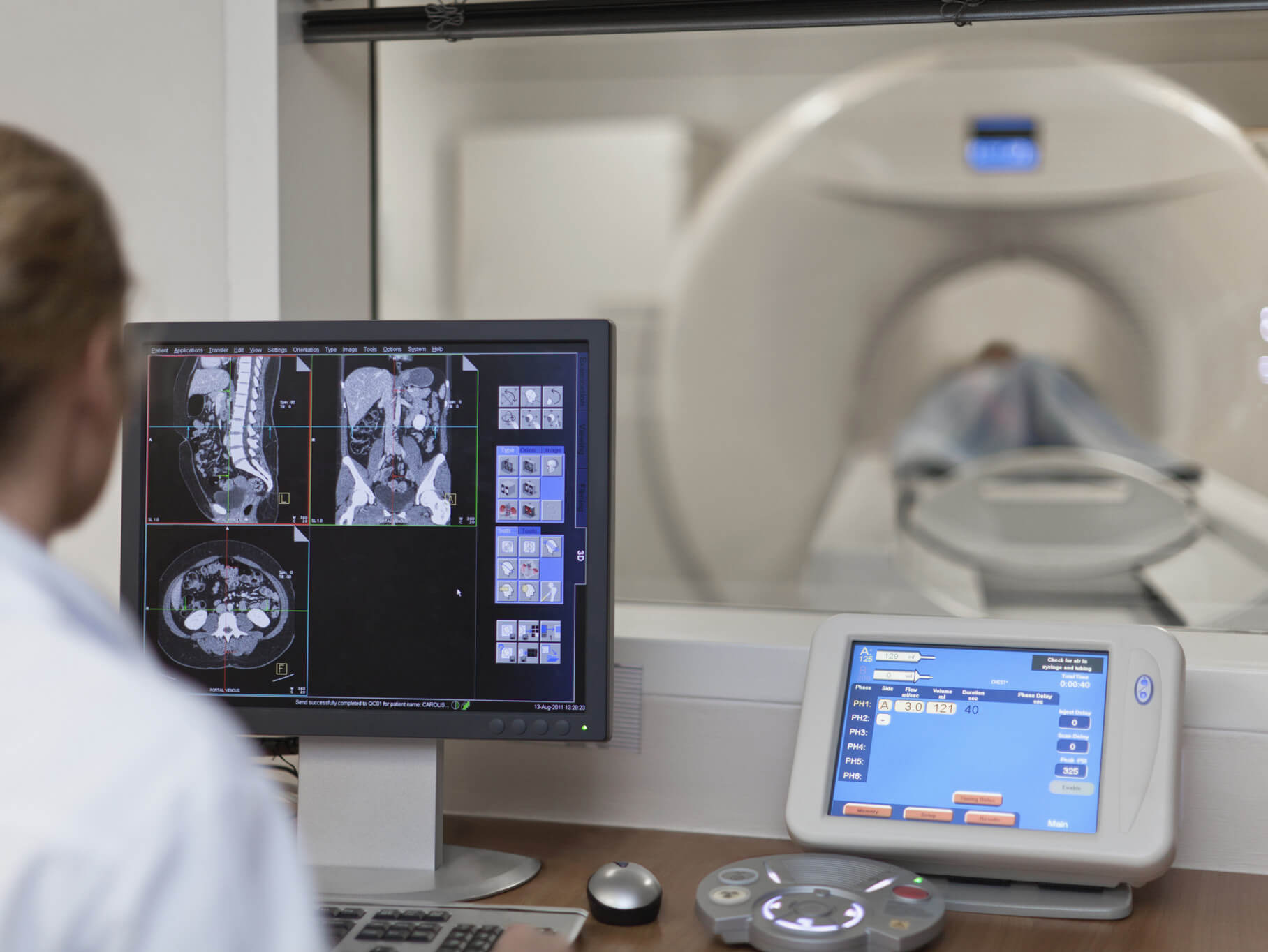 AI-Powered Cancer Screenings: A Breakthrough in Early Detection